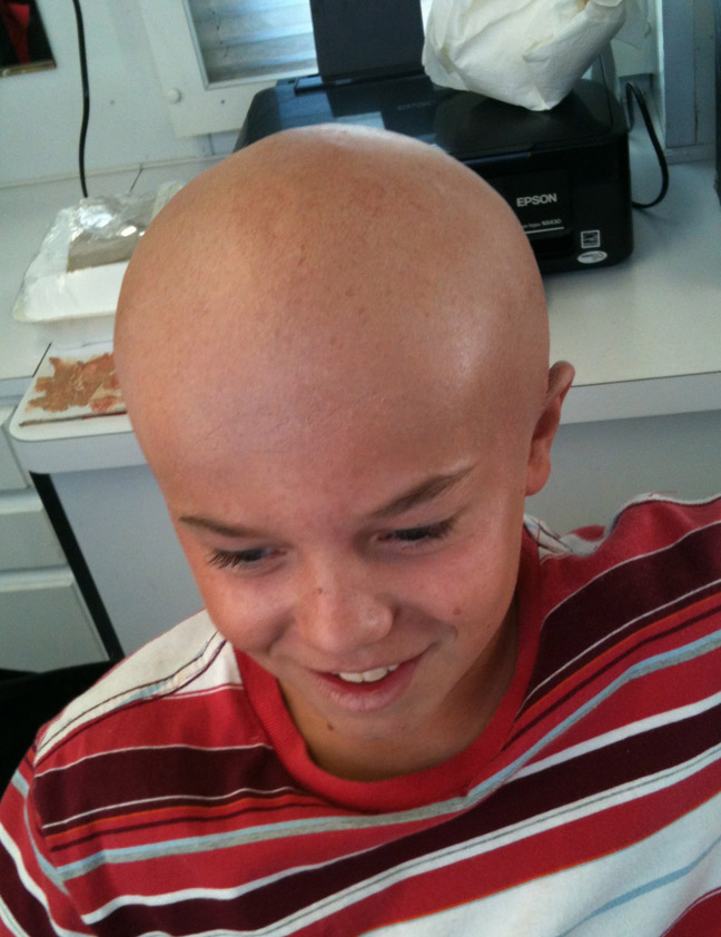 ralis-kahn-bald-cap-child1
